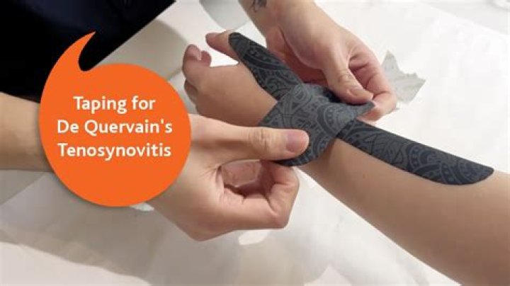 How do you tape De Quervain's tendonitis?