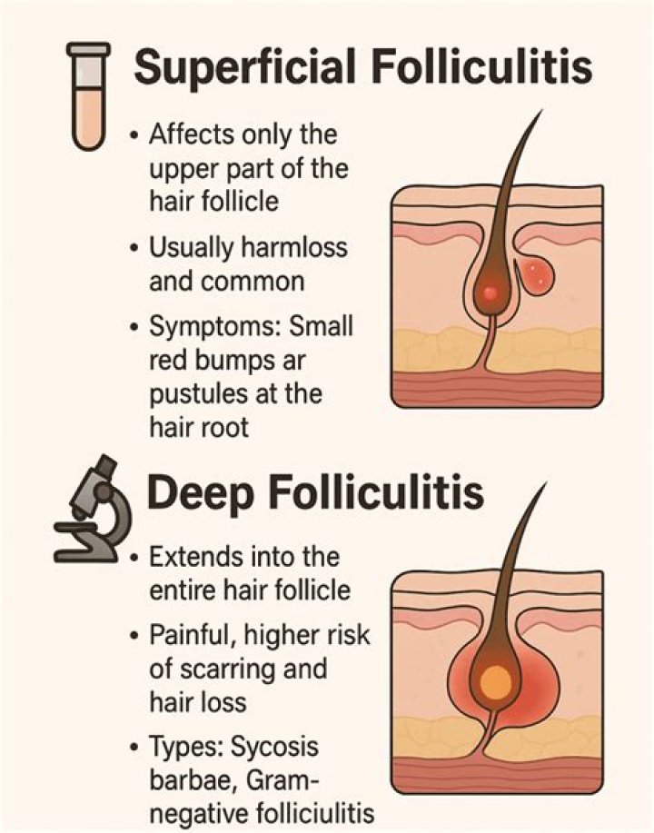 How do you treat clogged hair follicles?
