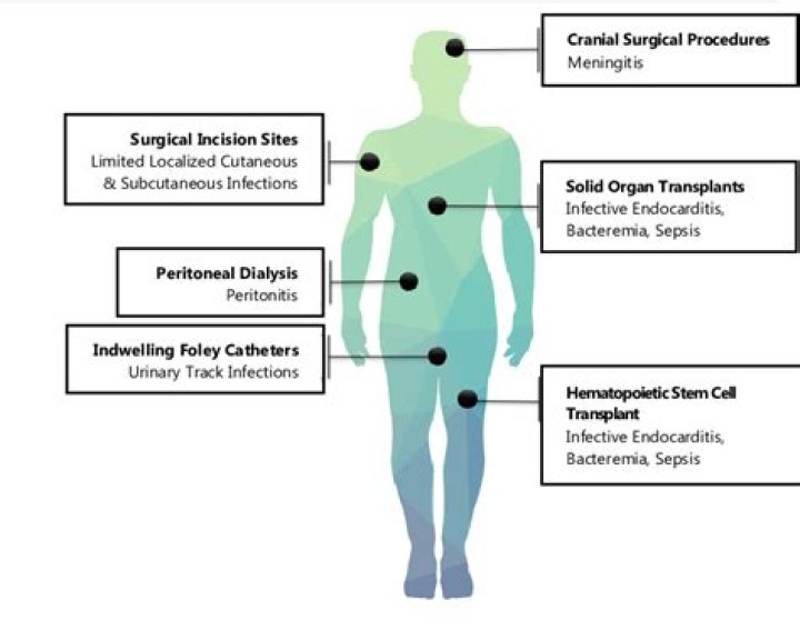How do you treat VRE in urine?