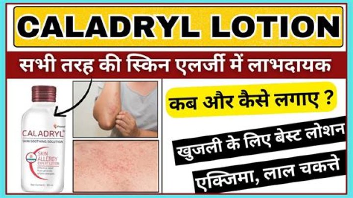 How do you use caladryl lotion on your face?