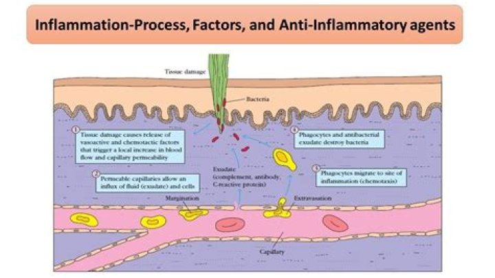 How does inflammation contribute to the immune response?