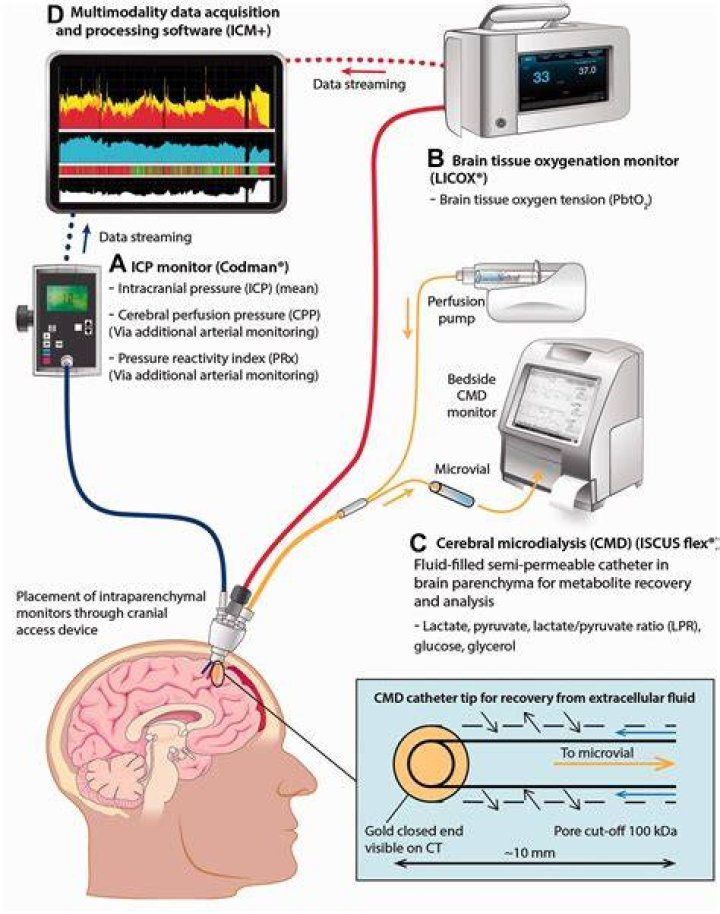 How is brain power measured?