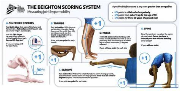 How is hypermobility diagnosed?