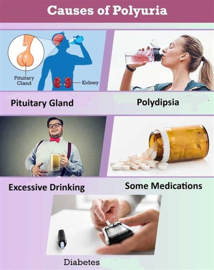 How is polyuria treated? | ContextResponse.com
