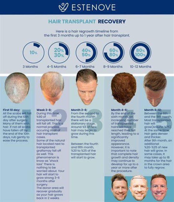 How long after a hair transplant Will my hair grow?