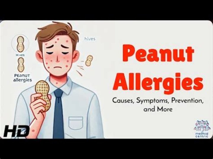 How long after eating peanuts will an allergic reaction occur?