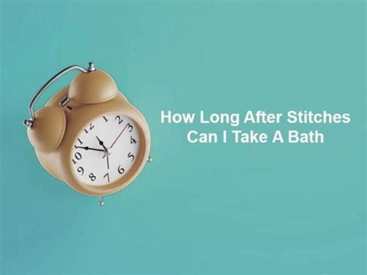 How long after stitches can I take a bath?
