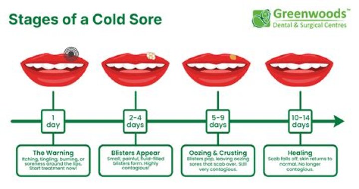 How long before scab falls off cold sore?