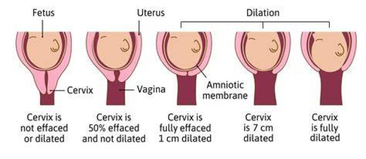 How long can you be 4 cm dilated before going into labor?