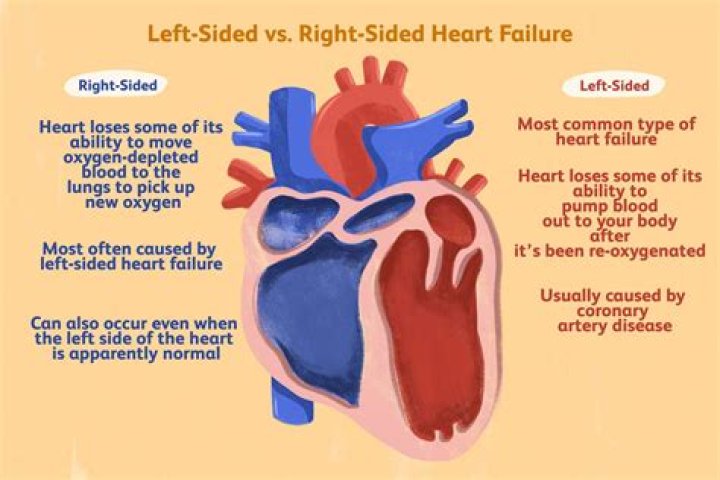 How long can you live with left ventricular failure?