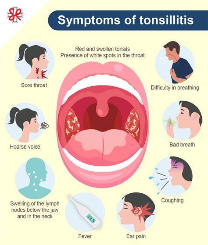 How long does fever last with tonsillitis?