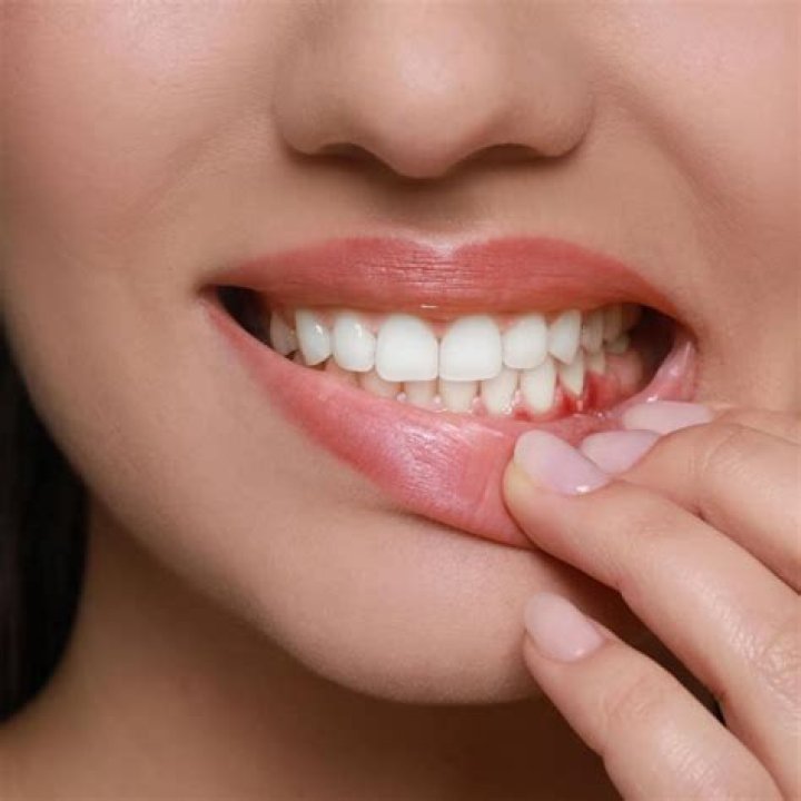 How long does it take for Arestin to take effect?