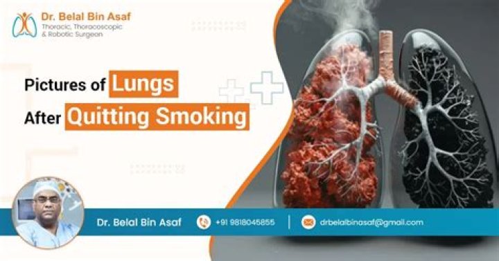 How long does it take for tar to leave your lungs?