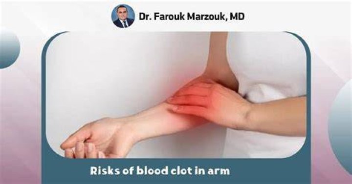 How long does it take to dissolve a blood clot in the arm?