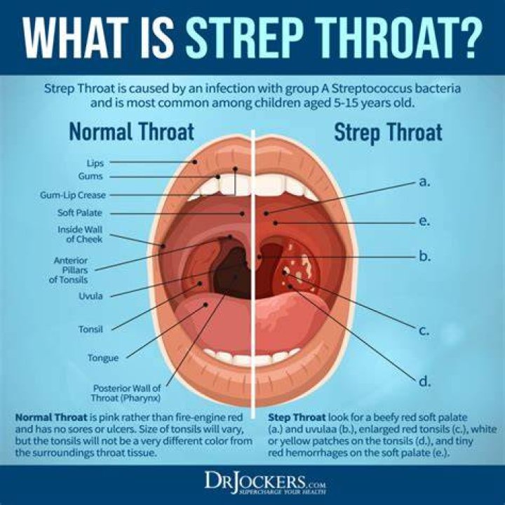 How long does it take to get rid of strep throat?