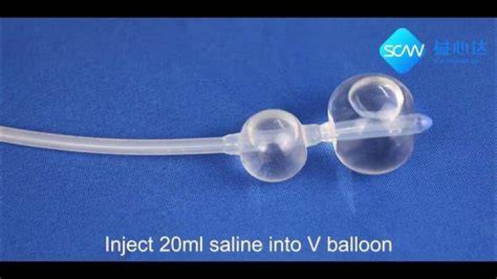 How long does it take to ripen the cervix?