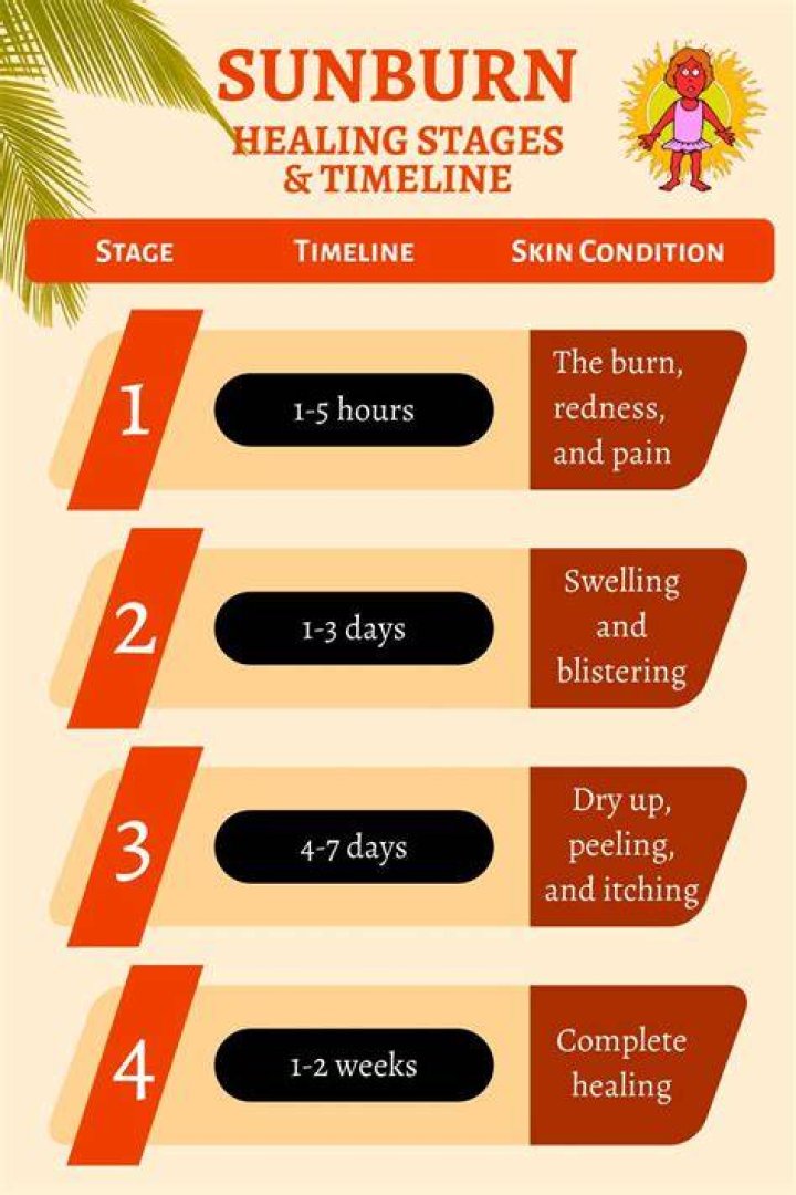 How long does swelling from sunburn last?