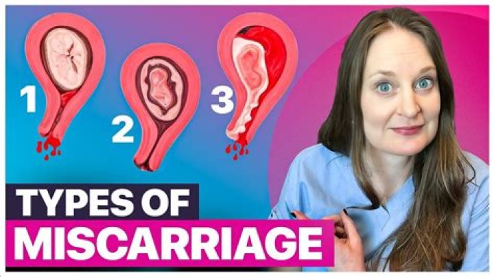 How long should I rest after miscarriage?