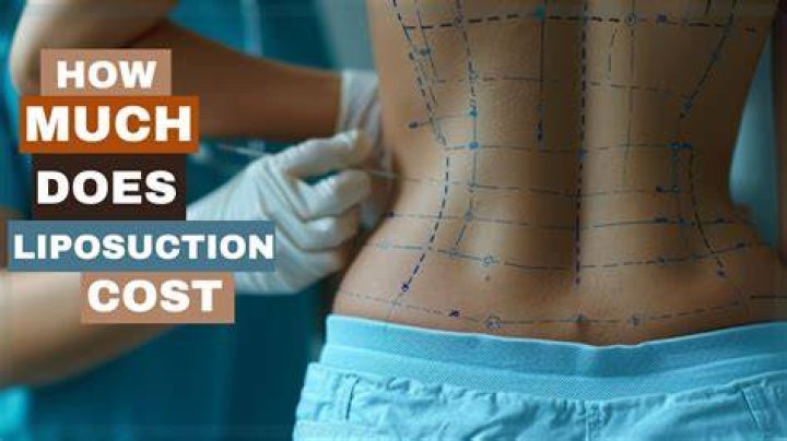 How much is liposuction for hips?