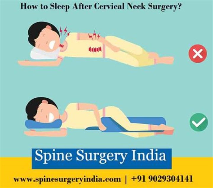 How should I sleep after cervical neck surgery?