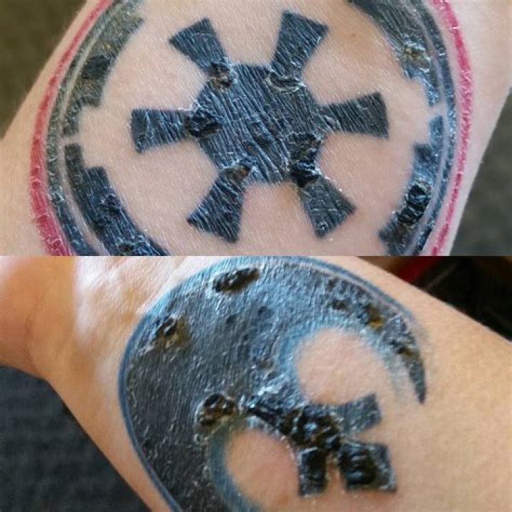 Is a healing tattoo supposed to peel?
