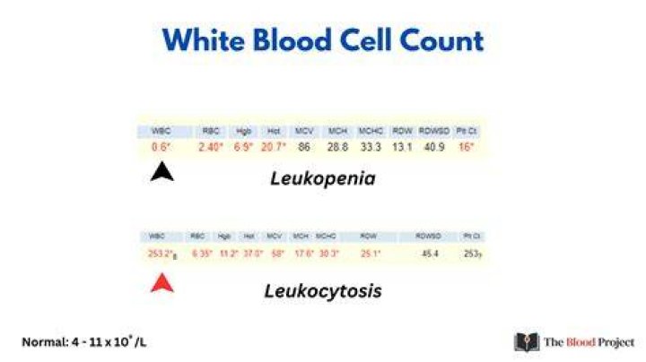 Is a white blood cell count of 11.8 high?
