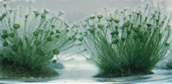 Is acetabularia the largest plant cell?