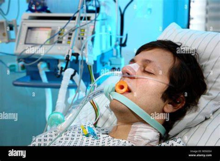 Is being intubated painful?