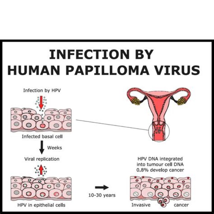 Is HPV virus airborne? | ContextResponse.com