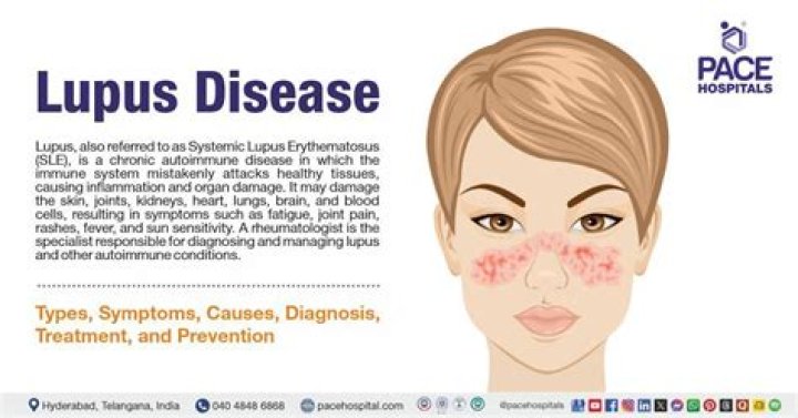 Is lupus a new disease?