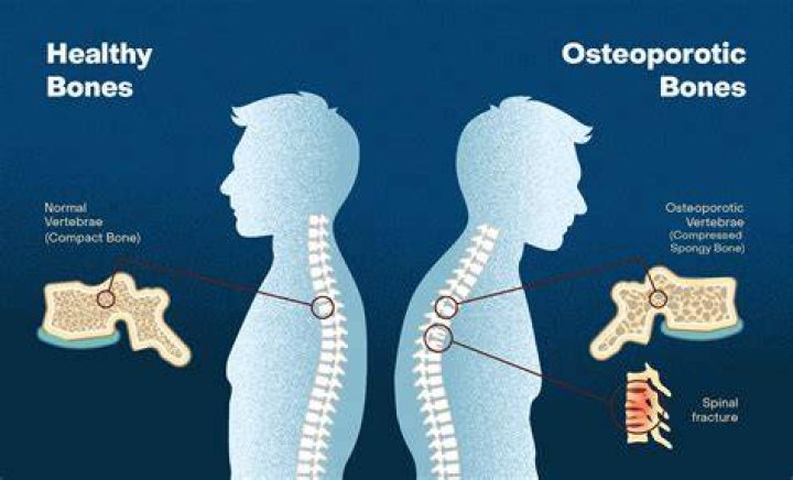 Is osteoporosis an orthopedic condition?