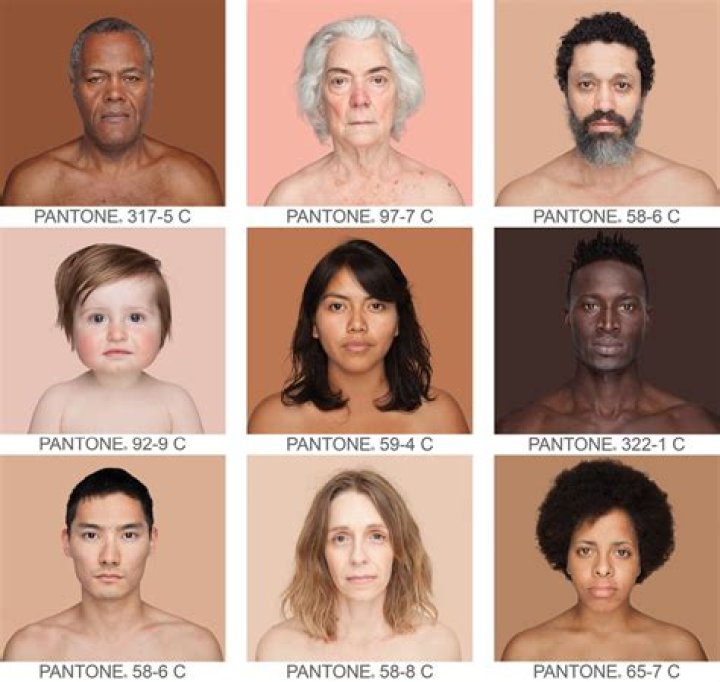 Is skin color a mutation?
