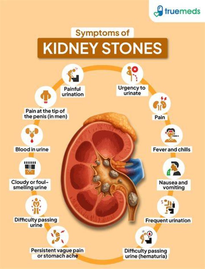 Is the description of the pain caused by the passage of a kidney stone?