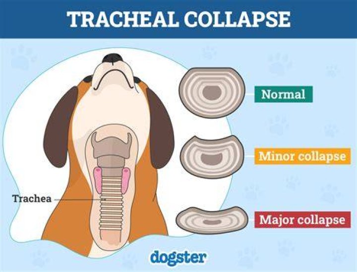 Is tracheal collapse fatal? | ContextResponse.com