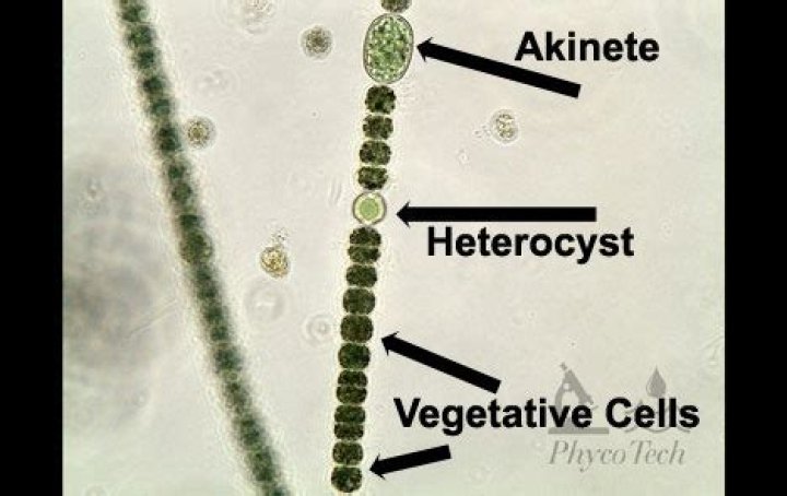 What are Akinetes and Heterocysts?