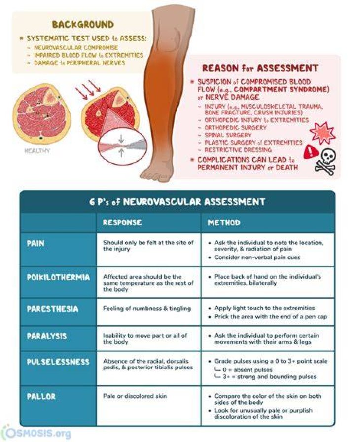 What are the 6 P of neurovascular assessment?
