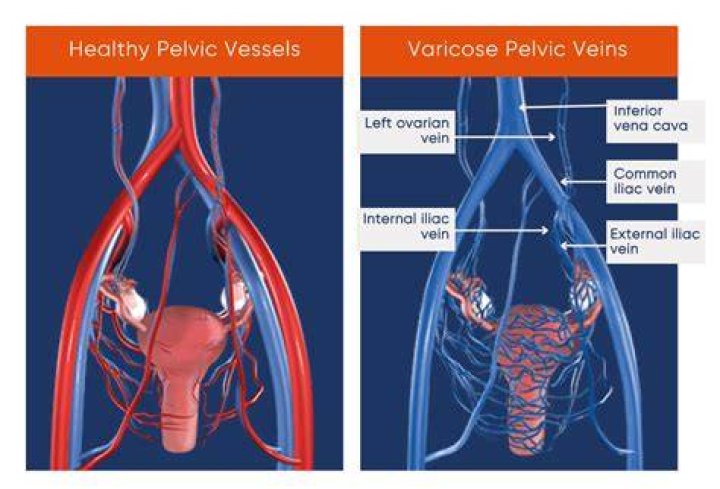 What are the cardinal veins?
