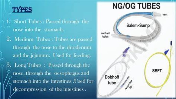 What are the different types of NG tubes?