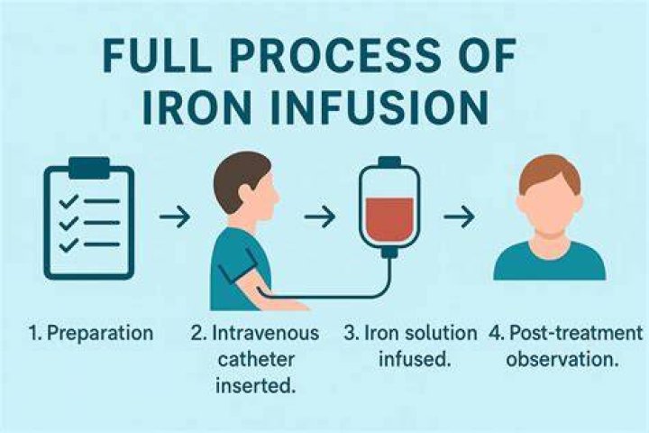 What are the side effects of having an iron infusion?