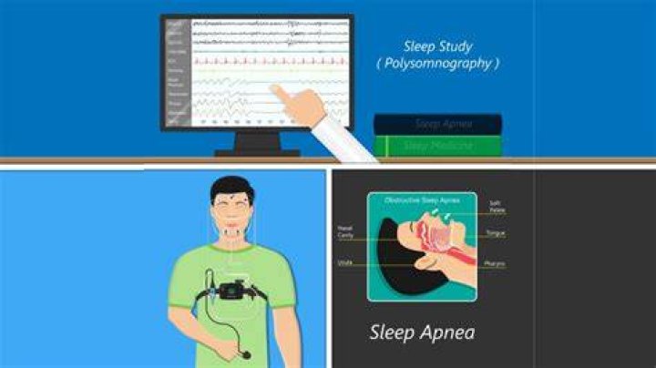 What can a sleep study diagnose?