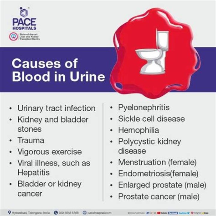 What causes blood clots in urine?