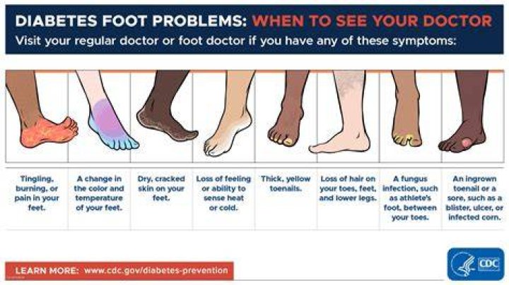 What causes diabetic foot?