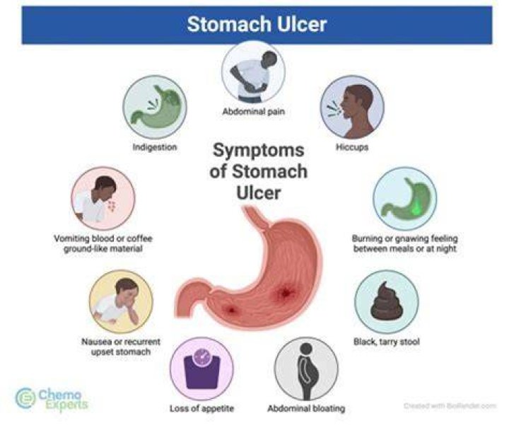 What causes gastric ulcers? | ContextResponse.com