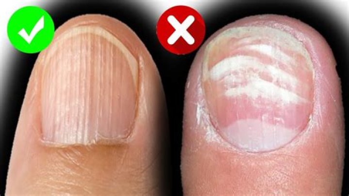 What causes nails to come out of drywall?