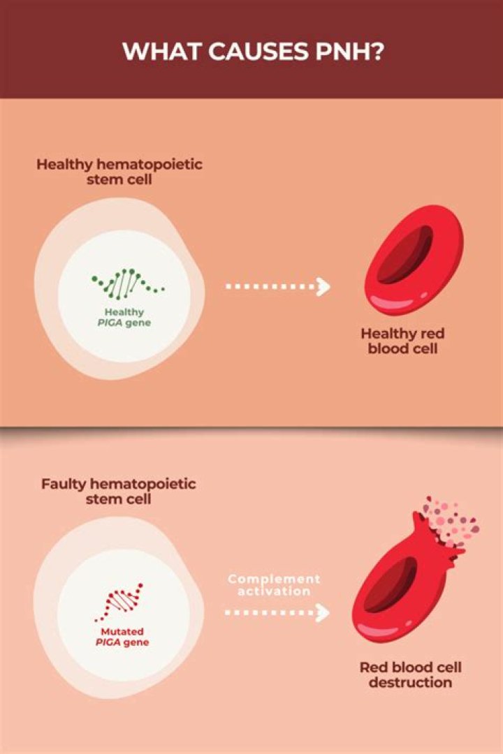 What causes PNH? | ContextResponse.com