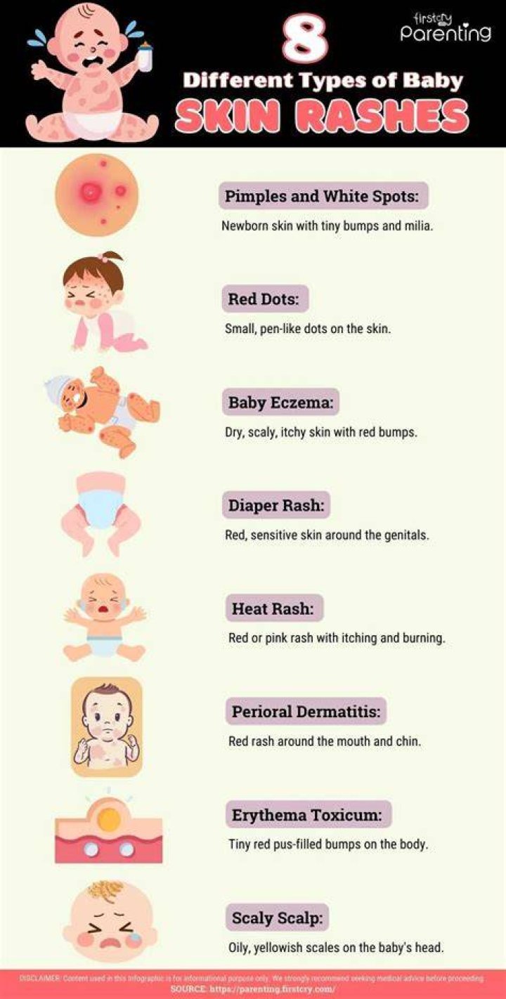 What causes rashes on babies face and neck?