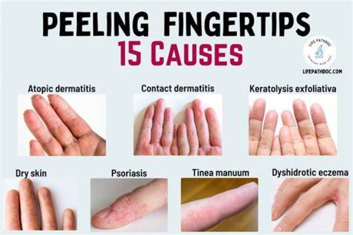 What causes skin to be elastic?