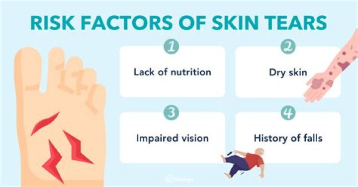 What causes skin to tear easily?
