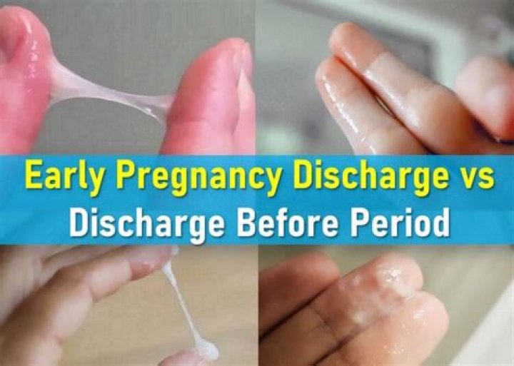 What causes watery discharge after period?