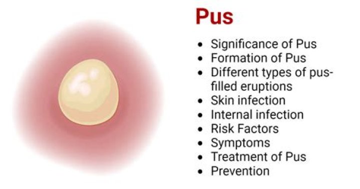 What cells make up pus?